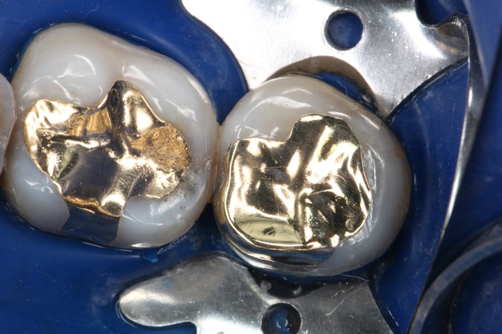 Mark Chun #17 finish