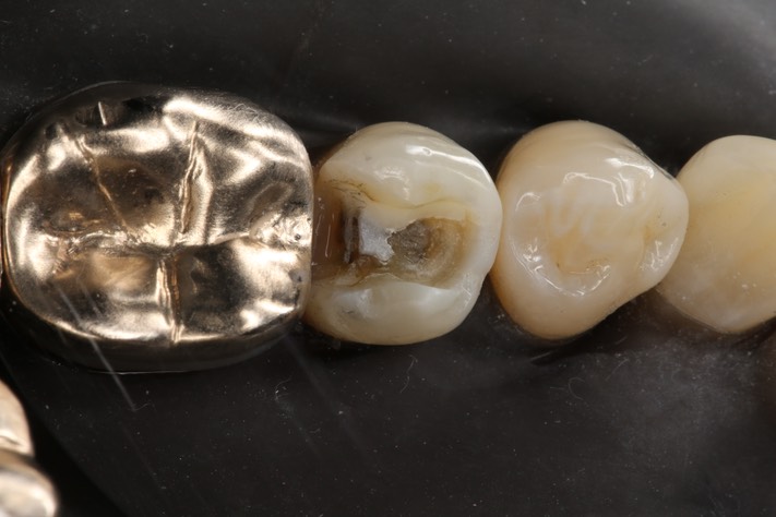 Russ Tabata #29 prep