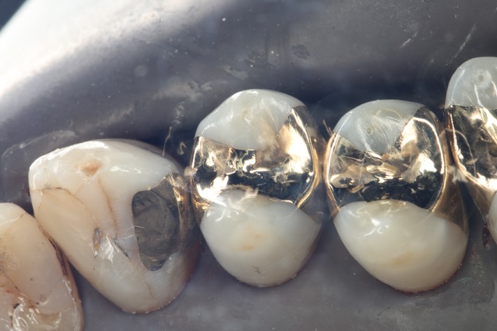 Larry Fujioka #4,5,6 finish