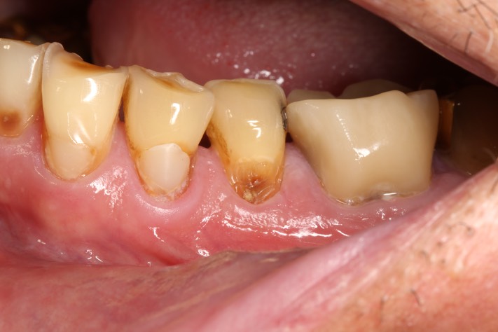 Ted Kanamori #20 pre-op