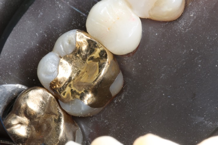 Wes Sato #14 open margin