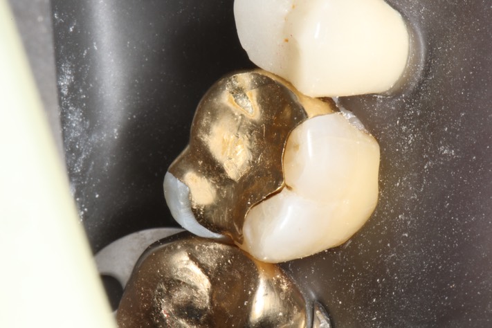 Wes Sato #14 open margin 2