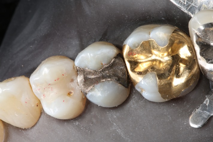 Bryan Sato #4 pre-op