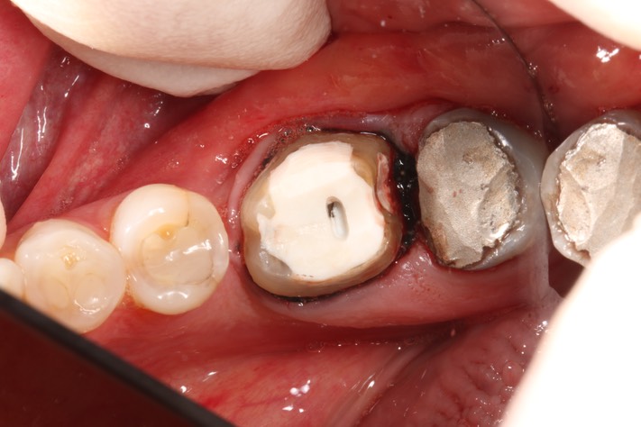 Matt Dodson #19 prep