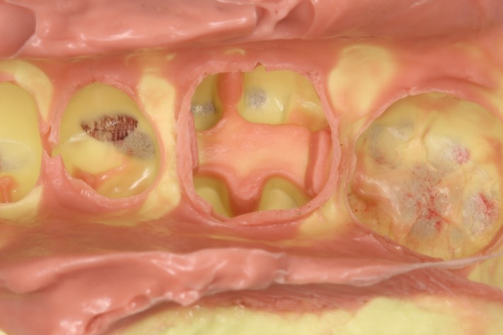 Alan Chinn #19 impression