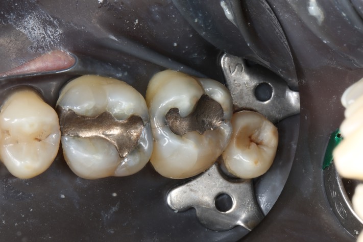 Ted Kanamori #2 pre-op