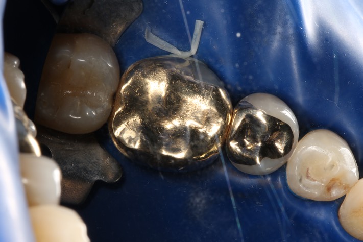 Mark Chun #29 finish