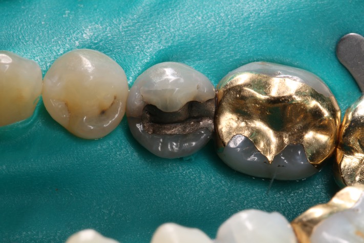 Mark Chun #20 pre-op