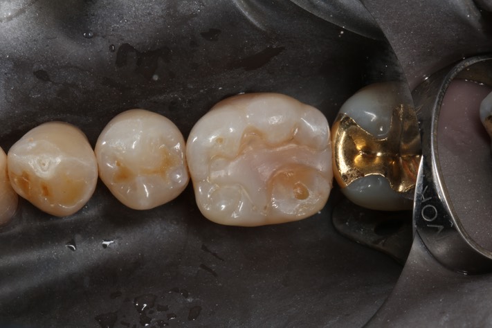 Scott Kanamori #19 pre-op