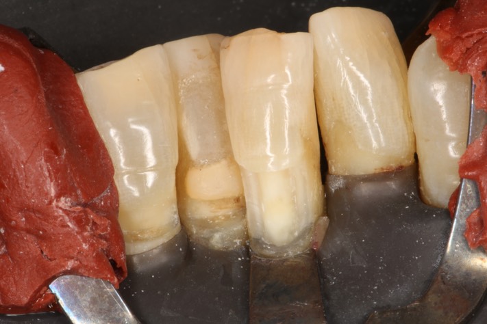 Ted Kanamori #24 prep