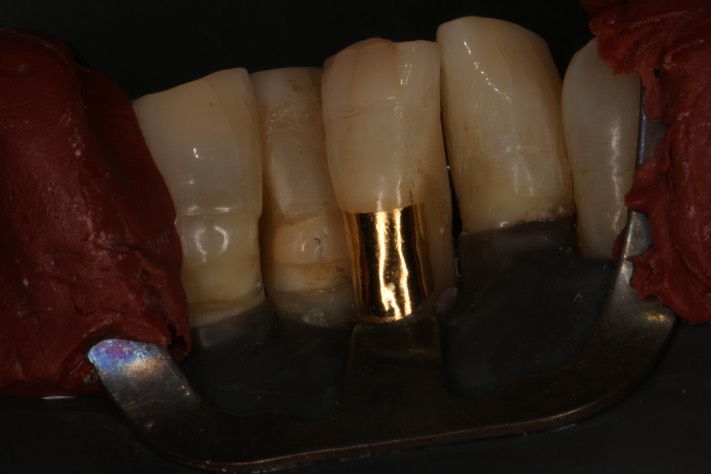 Ted Kanamori #24 finish