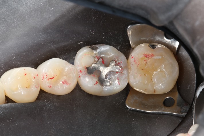 Alan Chinn #19 pre-op