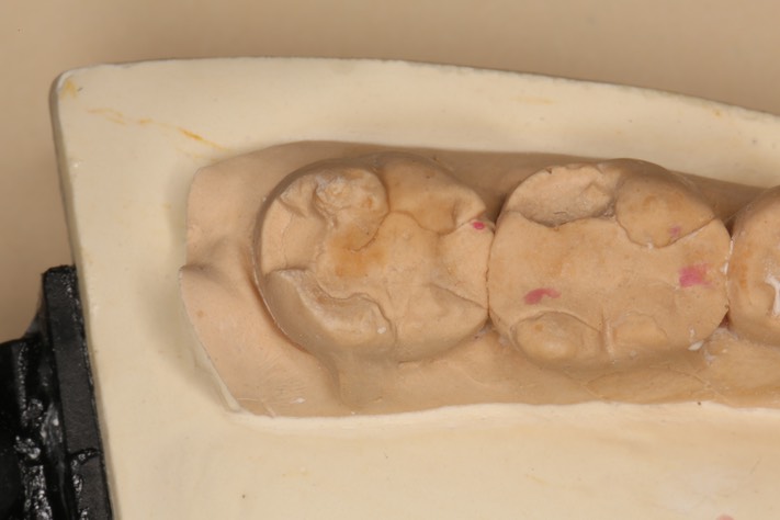 Kyle Chock #18 model