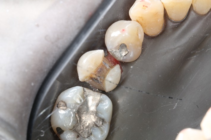 Scott Kanamori #29 prep