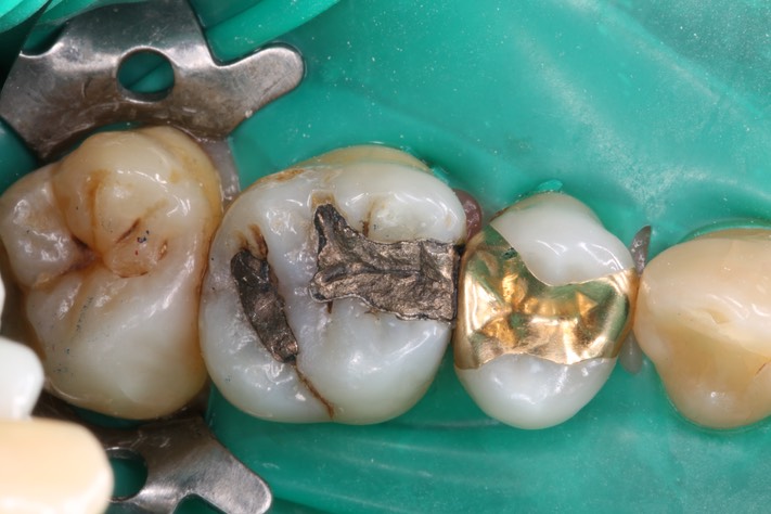 Alan Tamashiro #14 pre-op