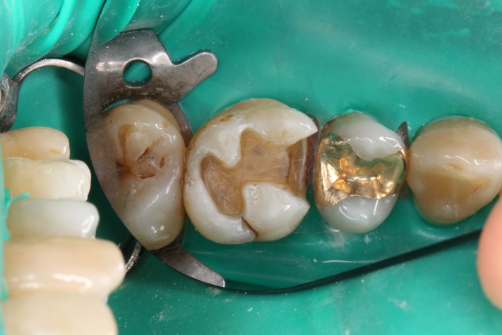 Alan Tamashiro #14 prep