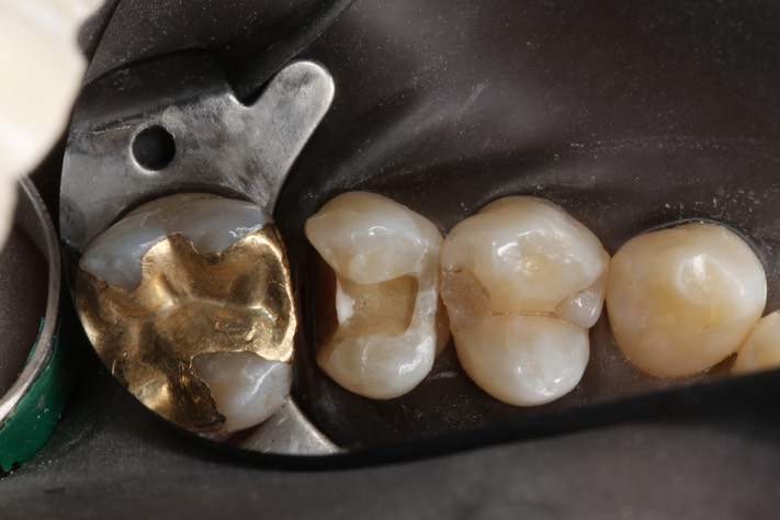 Mendel Sato #13 prep