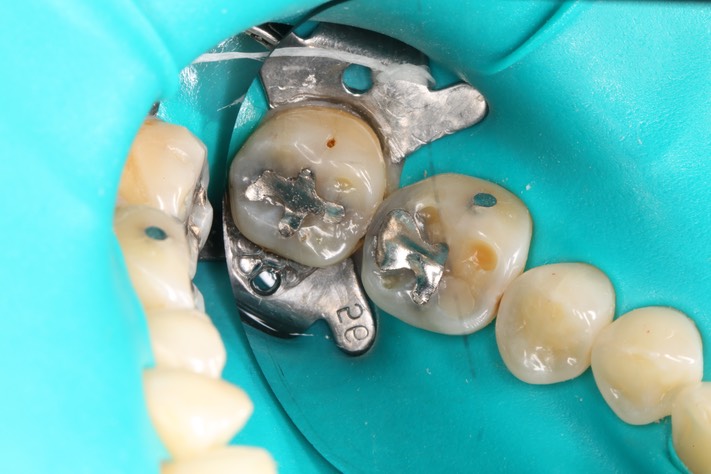 Bryan Sato #31 pre-op