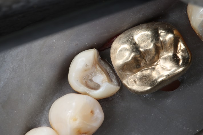 Larry Fujioka #20  re-prep