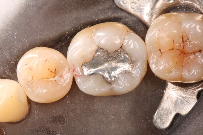 Alan Chinn #19 pre-op