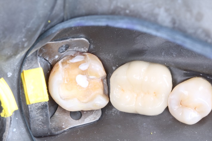 Scott Kanamori #31 prep