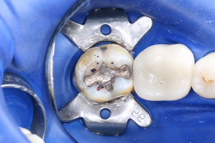 Mark Chun #31 pre-op