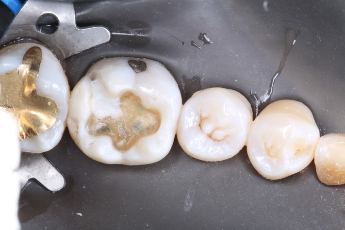 Frank Fukuda #19 prep