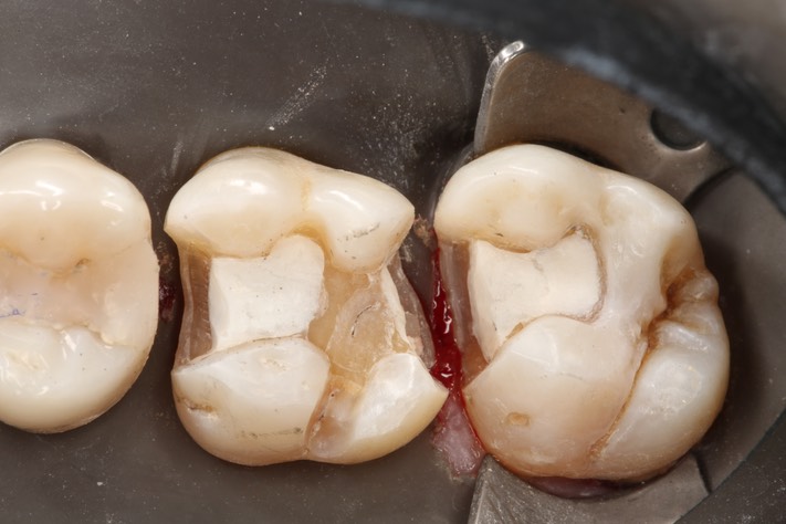 Ted Kanamori #2-3 prep