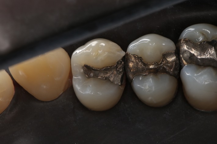 Wayne Chin #5 pre-op