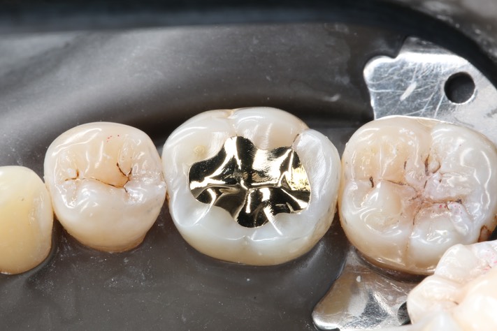 Alan Chinn #19 finish