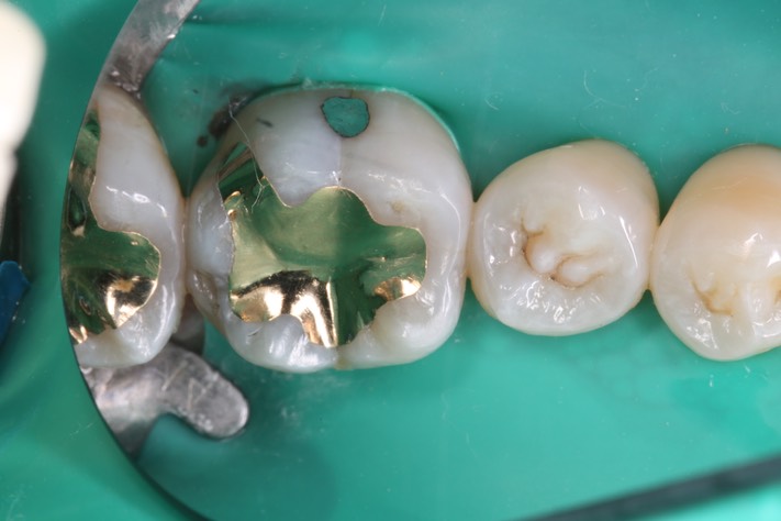 Frank Fukuda #19 finish