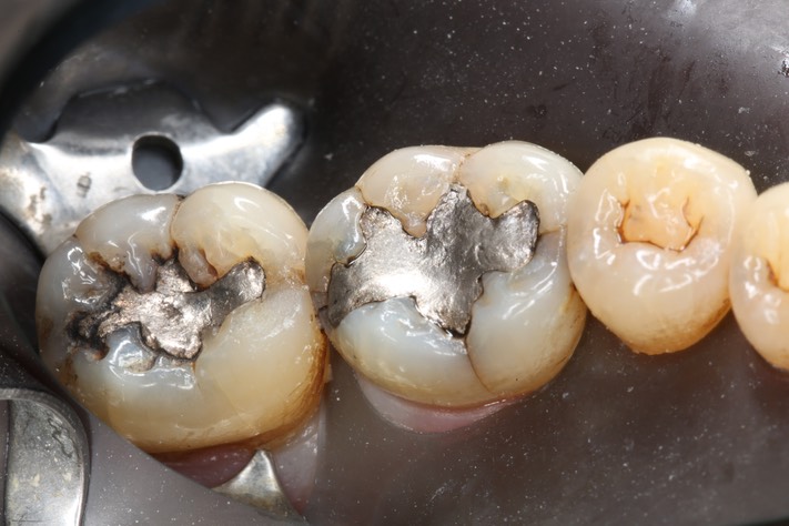 Alan Tamashiro #30 pre-op