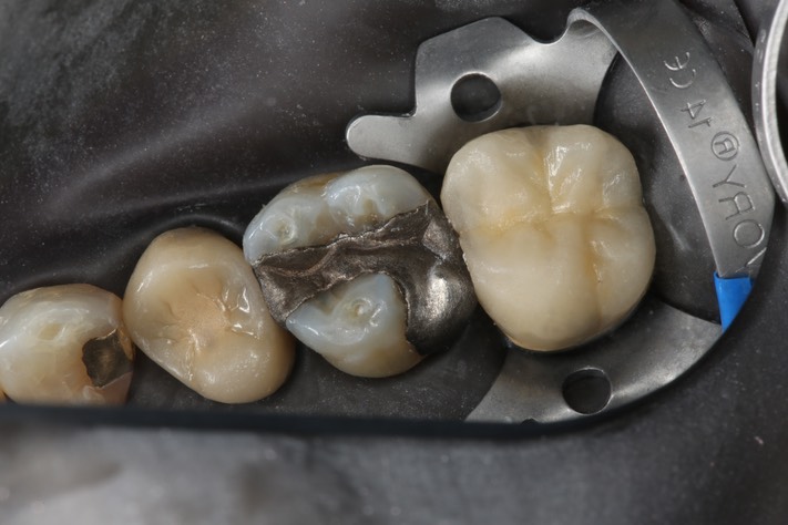 Frank Fukuda #3 pre-op