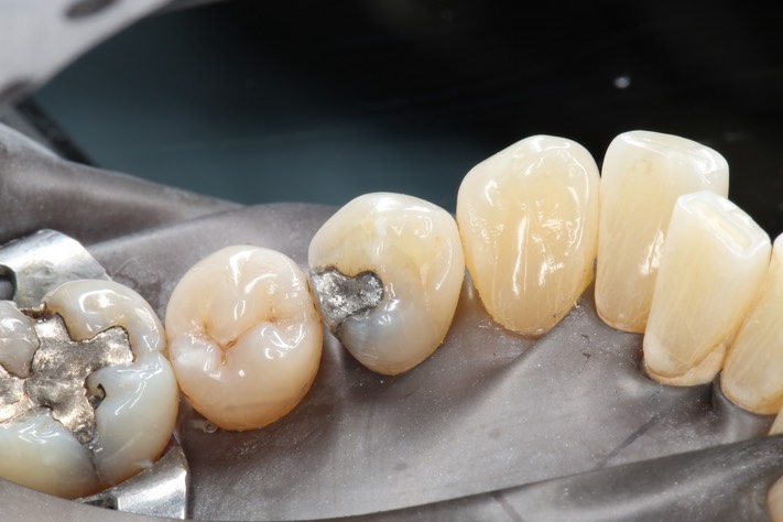 Larry Fujioka #28 pre-op