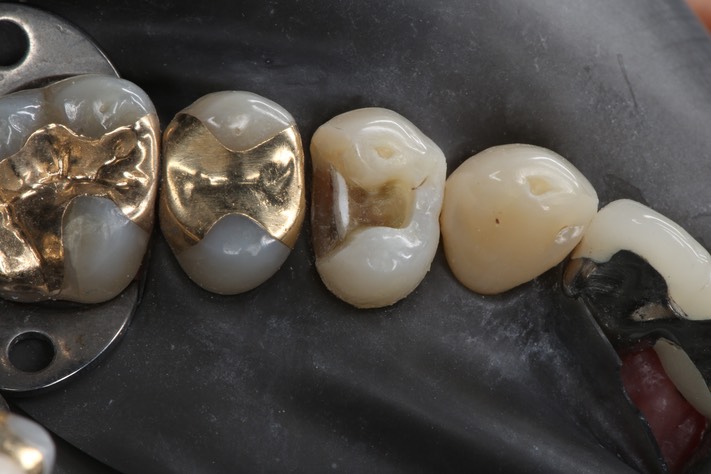 Scott Kanamori #12 prep