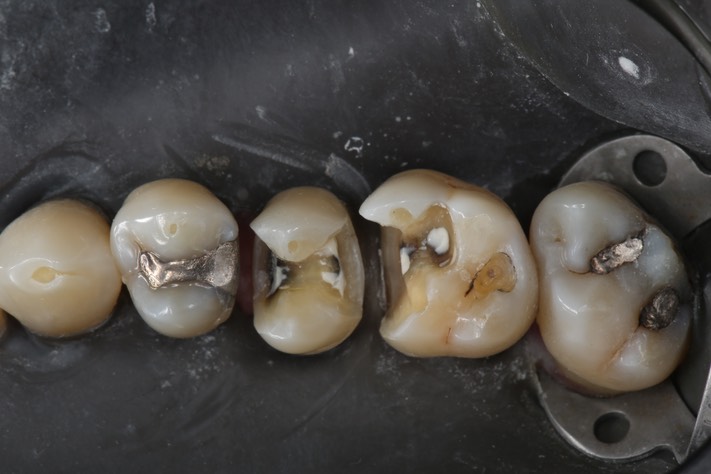 Gary Umeda #3 - 4 prep