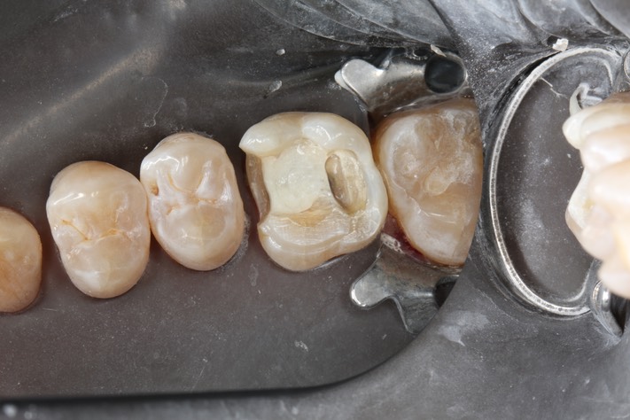 24Matt Dodson #3 reprep