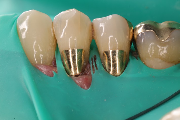 Mark Chun #28-29 finish