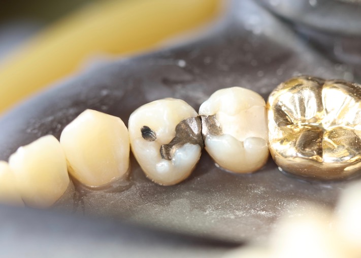 Frank Fukuda #20 pre-op