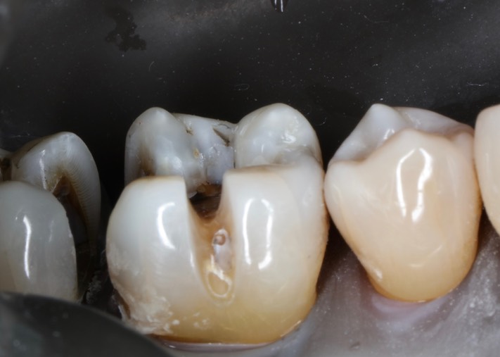 Kyle Chock #30-31 prep 3