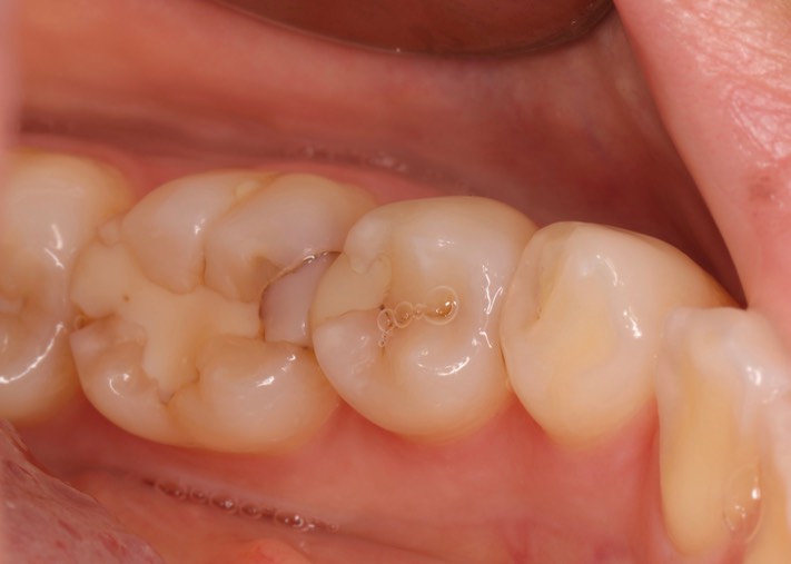 Gary Umeda #19-20 pre-op