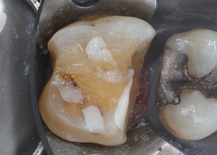 Matt Dodson #14 prep