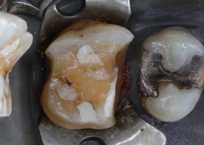 Matt Dodson #14 prep 2