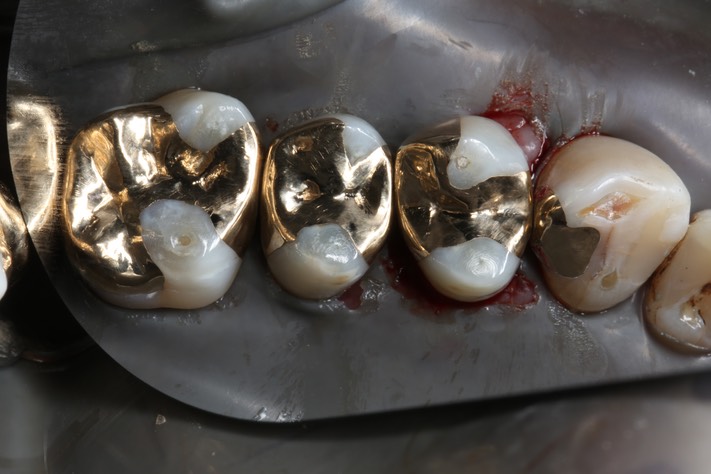 31Larry Fujioka #11 - 12 finish