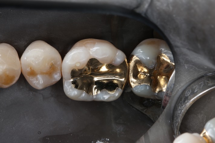 44Scott Kanamori #19 finish