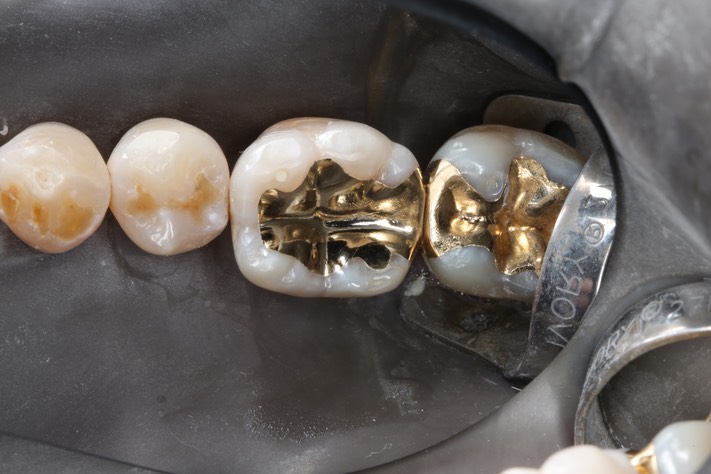 45Scott Kanamori #19 finish