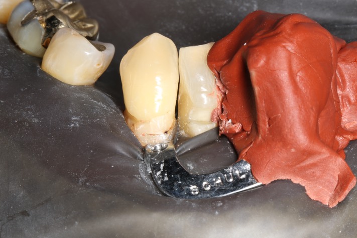 46Ted Kanamori #27 pre-op