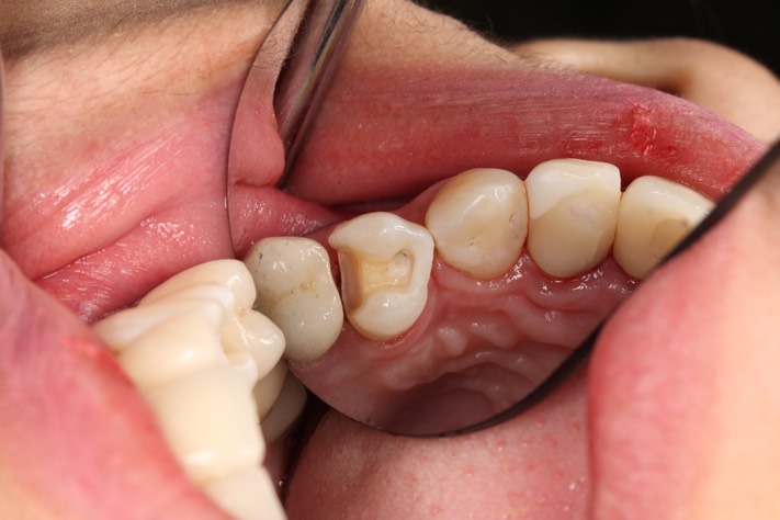 56Bryan Sato #12 prep