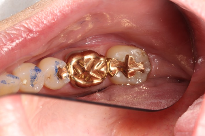 80Gary Umeda #18, 19, 20 try in