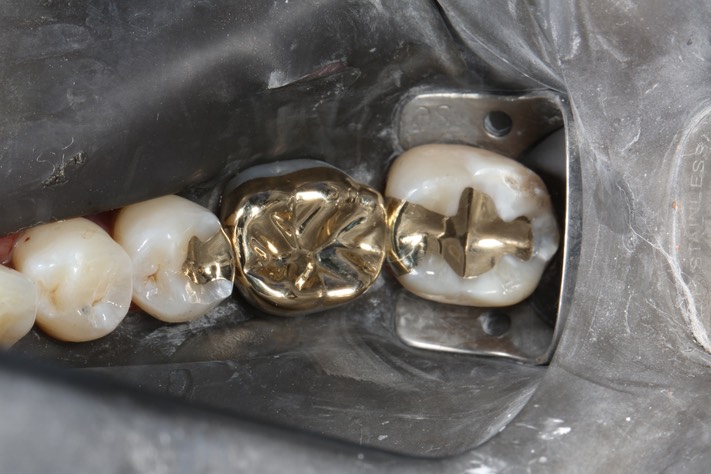 81Gary Umeda #18, 19, 20 finish